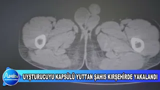 Kırşehirde 1 Kilo 159 Gram Uyşturucuyu Kapsülü Yuttan Şahıs Yakalandı