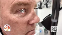 Cataract myths and misconceptions: What you need to know about cataract surgery