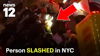 23-year-old slashed in head and arm in Brooklyn; man charged