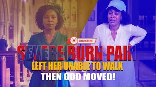 SEVERE BURN PAIN LEFT HER UNABLE TO WALK… THEN GOD MOVED!