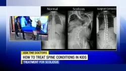 Ask the Doc: Spine conditions
