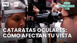 Cataratas oculares en Más Conectados: ¡aprende cómo afectan tu vista!
