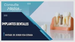 Implantes Dentales | Consulta Médica | SMRTV