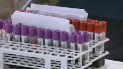 Krónika: Február 23-án indul a XVI. Civil Véradó Hét (2026.02.18.)