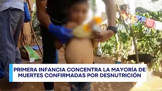 Central Dialogue | Acute malnutrition leaves 32 children dead in Guatemala in 2026