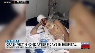 ‘I’m grateful he’s alive’: NKY suspected DUI crash victim faces long recovery