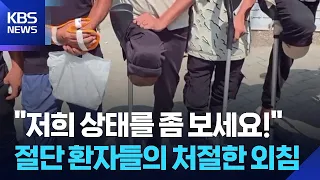 Amputee patients in Gaza plead: “Let us receive treatment” / KBS 08/13/2026.