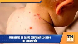 Ministerio de Salud confirma 12 casos de sarampión