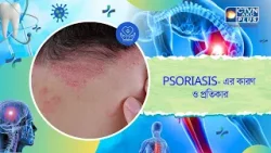 PSORIASIS  এর কারণ ও প্রতিকার। Health and Wellness