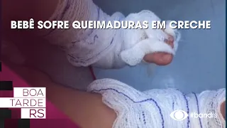 Baby suffers burns at daycare