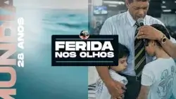 MILAGRE: FERIDA NOS OLHOS (especial 28 anos de IMPD) MILAGRE: FERIDA NOS OLHOS (especial 28 anos de IMPD)