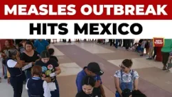 Mexico Issues Warning as Measles Outbreak Grows in Jalisco | World News | Health News | India Today