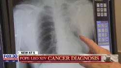 Doctor warns not smoking doesn’t make you immune to lung cancer