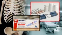 ALARM shëndetësor? Ozempic SHKËPUT kockat, Studimi ZBULON të dhëna të FRIKSHME