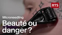 Microneedling à domicile : risques et dangers de cette tendance beauté | RTS