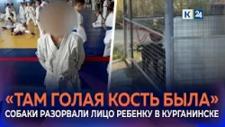 Dogs maul 12-year-old boy's face at a pay-to-fish lake in Kuban