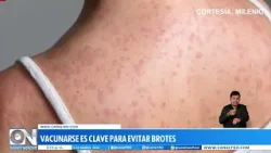 Alerta por sarampión en Colombia: confirman casos en Santander y medidas de prevención