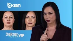 Nuk duket më 50! Shikoni fytyrën e re të Julia Ilirjan, mbeteni pa fjalë! Doktor Plastik VIP TV KLAN