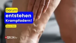 The True Causes of Varicose Veins – What Hardly Anyone Explains | Empirical Medicine | QS24