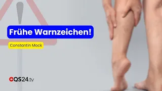 Diese Warnzeichen zeigen, dass dein Venensystem kippt | Erfahrungsmedizin | QS24