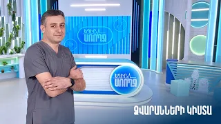 Եղիր առողջ. ձվարանների կիստա