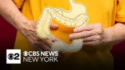 Doctors see rise in colorectal cancer in middle-aged people