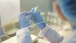 Morbo di Creutzfeldt-Jakob. Un altro caso nell'Aretino. Documenti alla famiglia dopo un anno