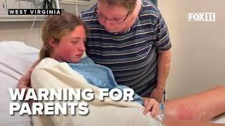 Popular squishy toy sends teen to hospital with burns, what parents should know