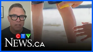 Sunscreen misinformation: What you need to know as temperatures rise