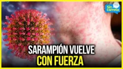 Sarampión en Colombia: ¿Peligro de epidemia? Tres casos confirmados en Bogotá | Sin Carreta Canal 1