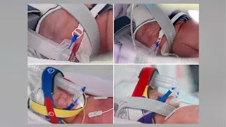 Woman gives birth to rare identical quadruplet daughters