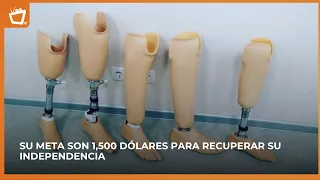A prosthetic could make the difference: woman from Palacagüina asks for help