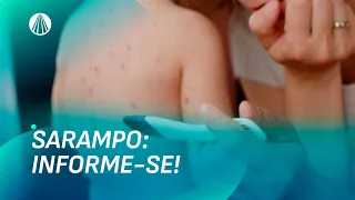 Sarampo está de volta: infectologista alerta sobre os perigos reais da doença | Viva a Tarde