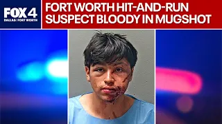 Two victims hospitalized by bloody suspect in Fort Worth