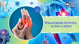 Rheumatoid Arthritis এর কারণ ও প্রতিকার। Health and Wellness