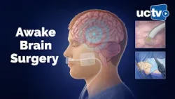 Операция на головном мозге в сознании для защиты речи