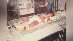 She survived 7 open heart surgeries by 12 years old. Now, she's colleagues with her care team.