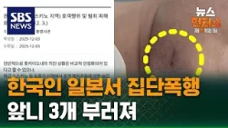 [빅토픽] 한국인 일본서 집단폭행…앞니 3개 부러져 / SBS / 뉴스헌터스