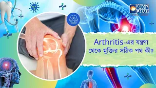 Arthritis এর যন্ত্রণা থেকে মুক্তির সঠিক পথ কী