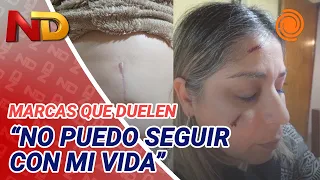 She was STABBED at WORK and is demanding action from workers' comp: "I can't live a normal life"