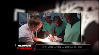Telefuturo te Informa - ¿Qué es la Viruela Mono?