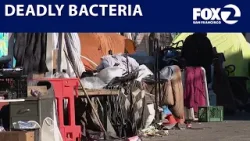 Deadly bacterial outbreak found at Berkeley encampment
