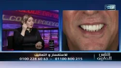 الناس الحلوة | خطوات زراعة الاسنان مع دكتور اسراء احمد السعيد