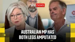 BREAKING: Australian MP hit by a car has both legs amputated