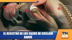 El registro de los casos de Guillain Barré