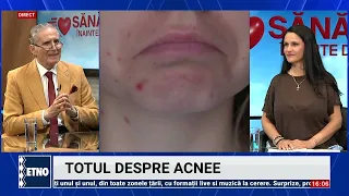 Acne. Health Above All Else September 14, 2026. Gen. Prof. Dr. Ioan Nedelcu