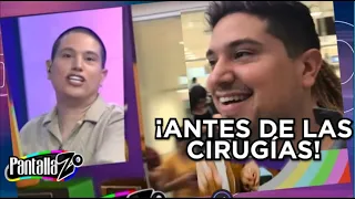 Revelan fotos de Aldo Muñiz antes de sus cirugías | Pantallazo