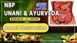 Bowel Obstruction  |  NBP UNANI & AYURVEDA RESEARCH CENTRE #ayurveda #healthcare