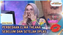 Elma Theana Tunjukan Perbedaan Dirinya Sebelum Dan Setelah Oplas - RUMPI (1/2/26) P3