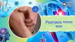 Psoriasis সমস্যার কারণ। Skin Care